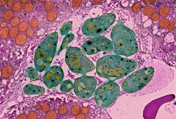 Imagen: Micrografía electrónica de transmisión a color (TEM) del parásito Toxoplasma gondii (verde), la causa de la toxoplasmosis (Foto cortesía de Moredun Scientific).